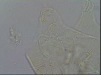 Testechiniscus laterculus image