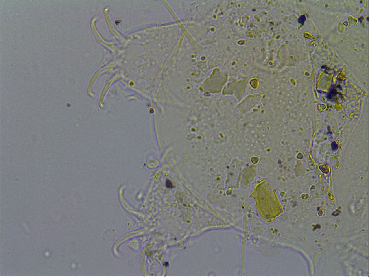 Testechiniscus laterculus image