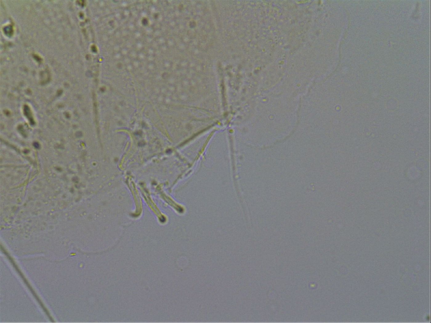 Testechiniscus laterculus image