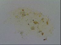 Testechiniscus laterculus image