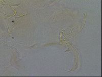 Testechiniscus laterculus image