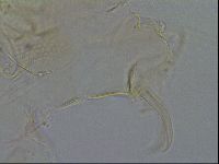 Testechiniscus laterculus image