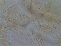 Testechiniscus laterculus image