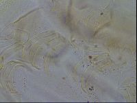 Testechiniscus laterculus image