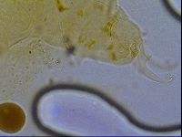 Testechiniscus laterculus image