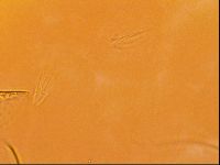 Testechiniscus laterculus image