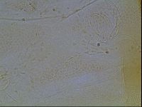 Testechiniscus laterculus image