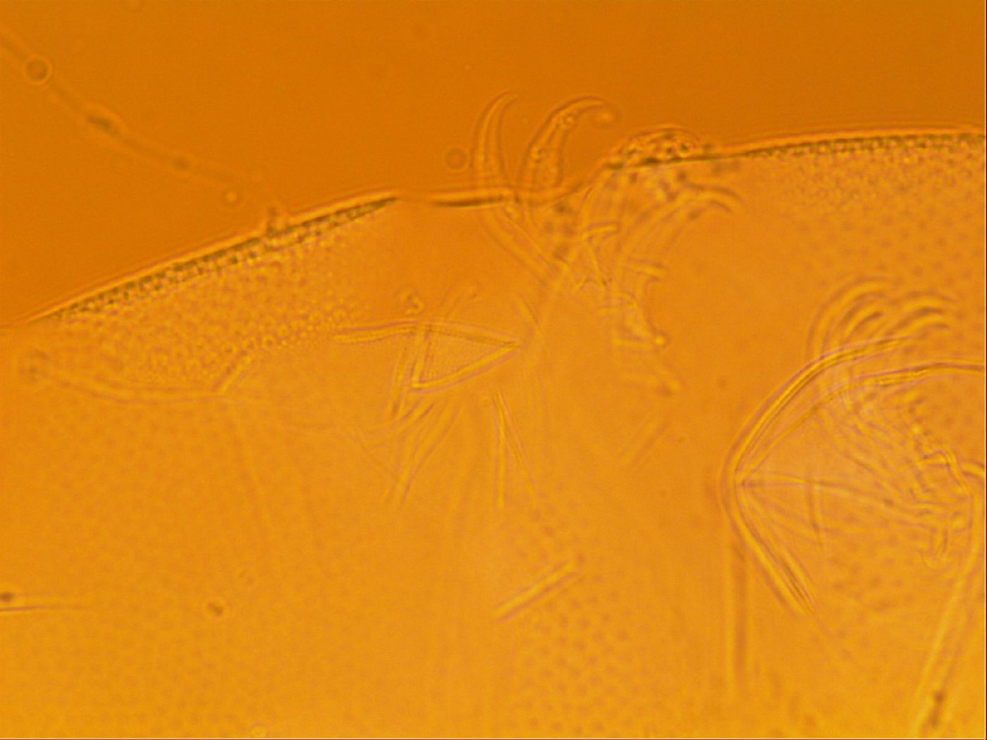 Testechiniscus laterculus image