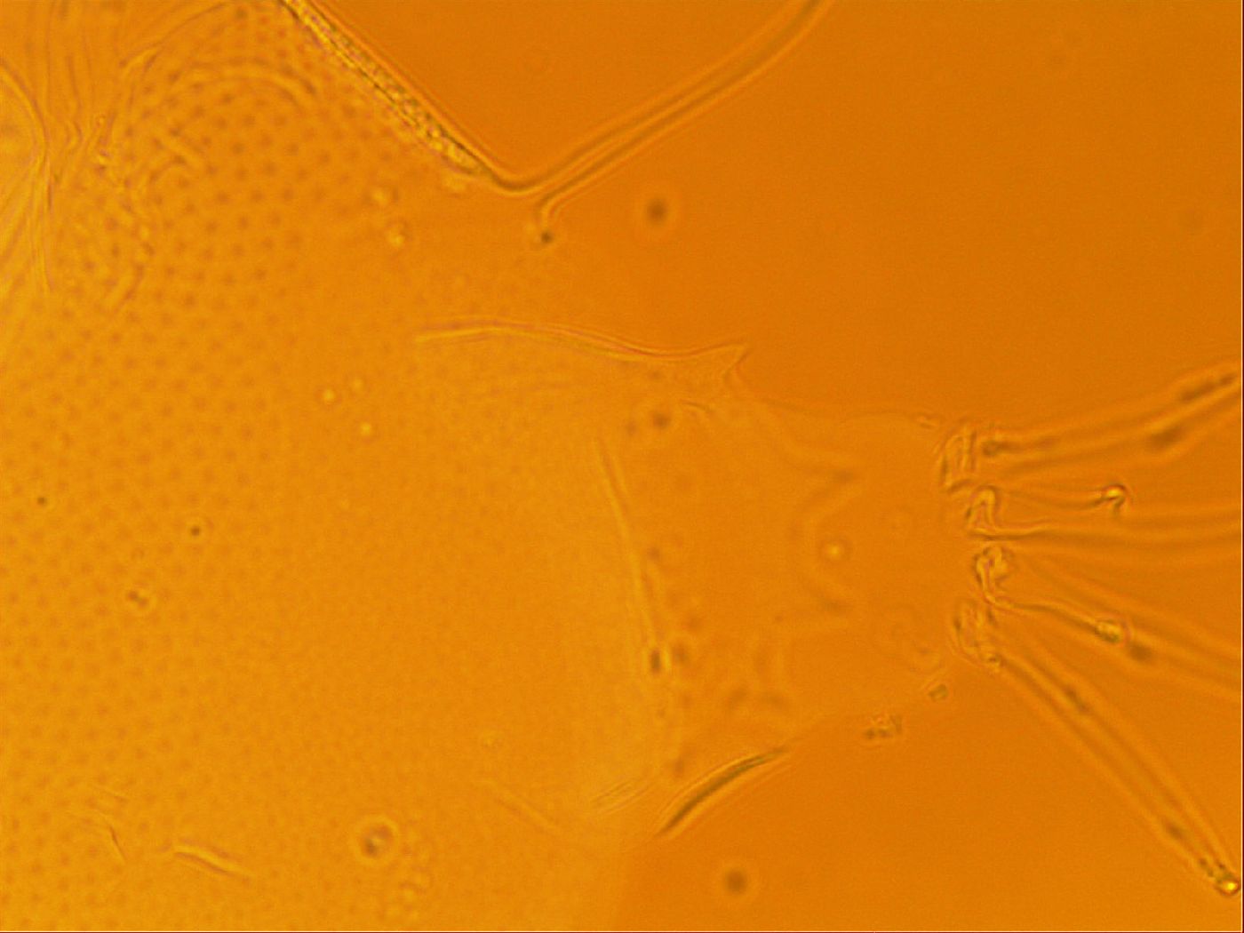 Testechiniscus laterculus image