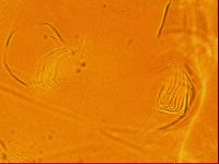 Testechiniscus laterculus image