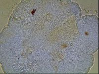 Testechiniscus laterculus image