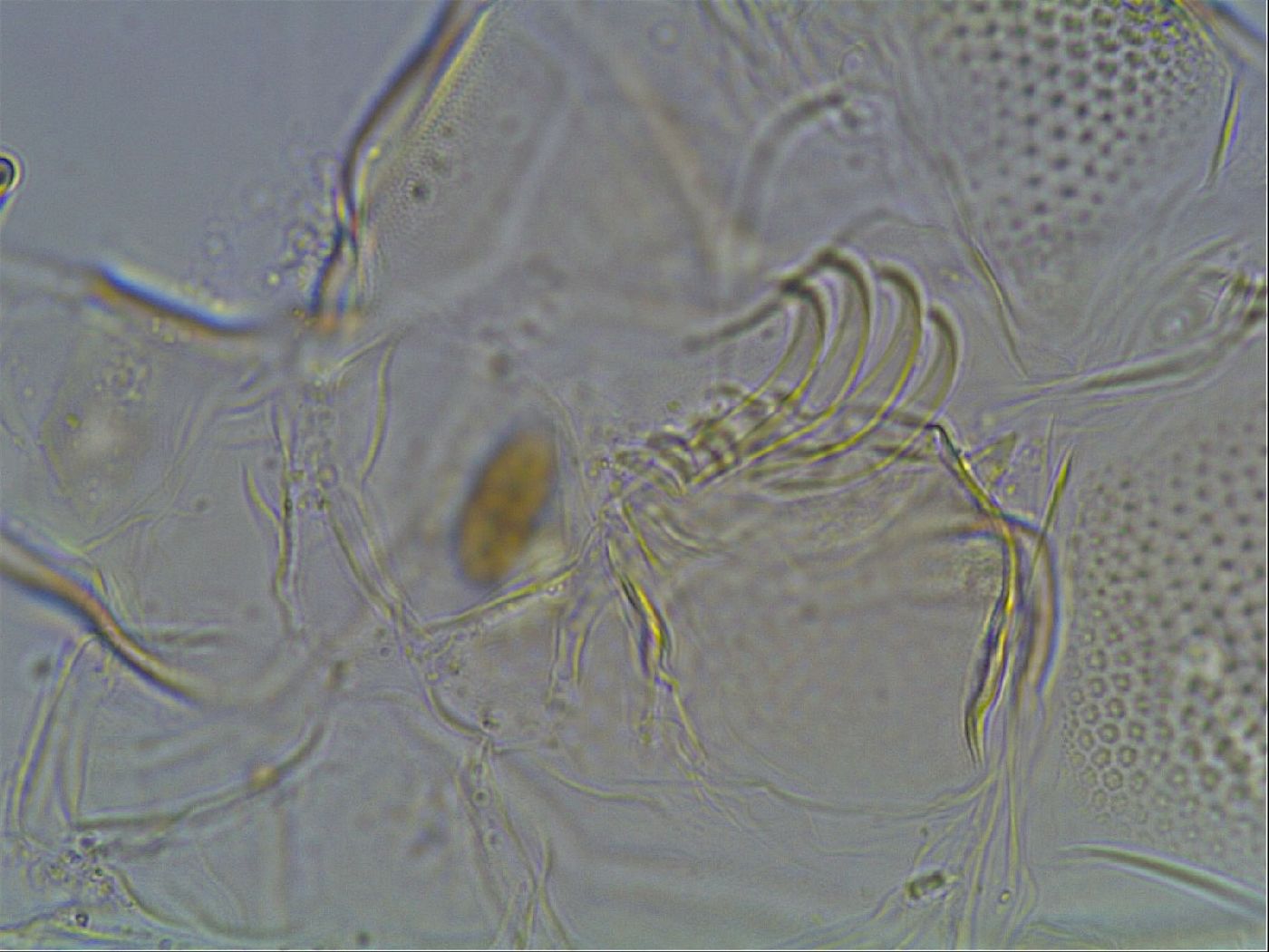 Testechiniscus laterculus image
