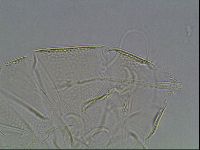 Testechiniscus laterculus image