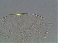 Testechiniscus laterculus image