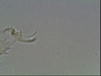 Testechiniscus laterculus image