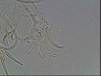 Testechiniscus laterculus image