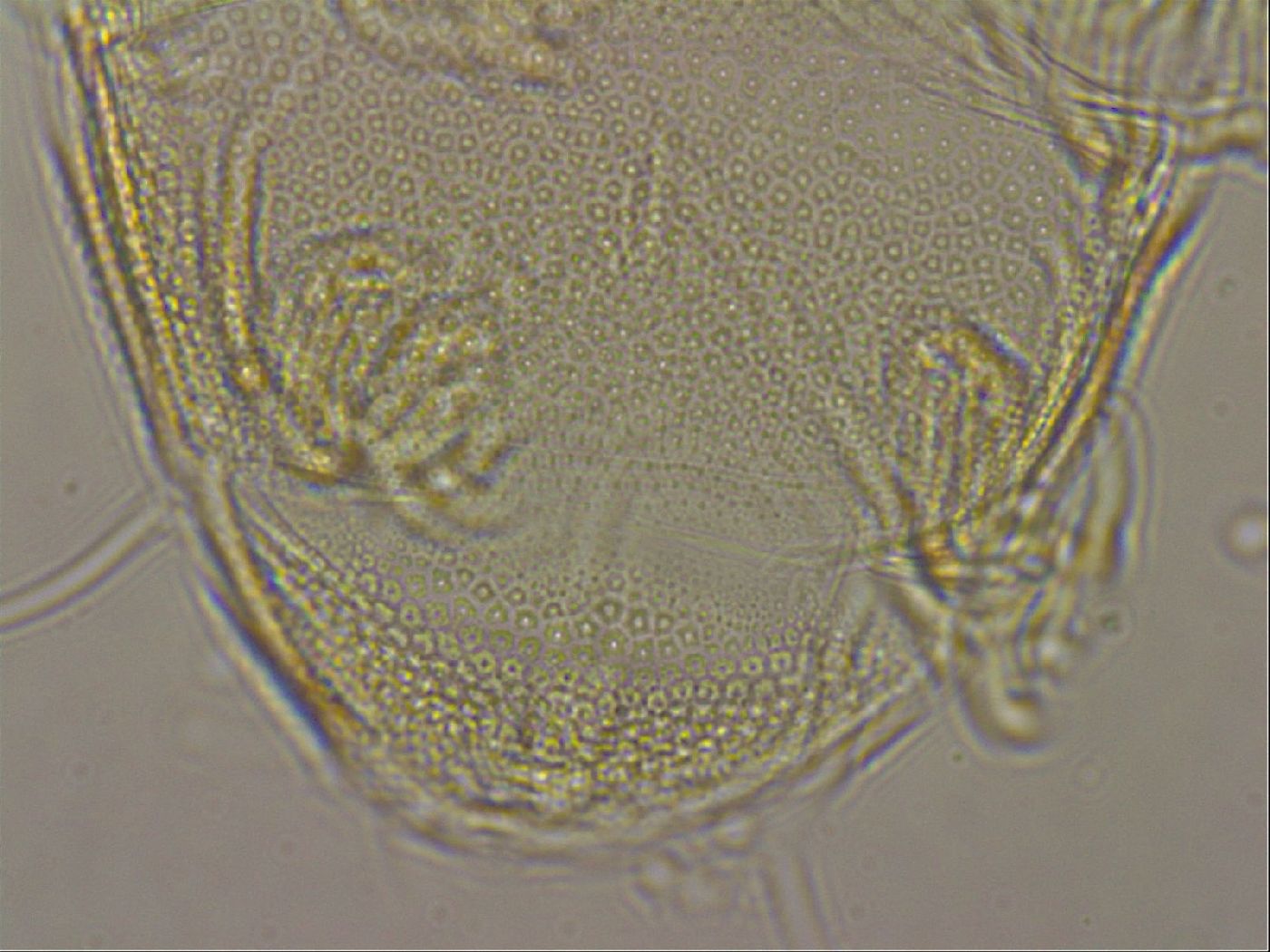 Testechiniscus laterculus image