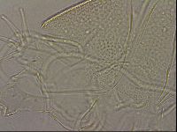 Testechiniscus laterculus image