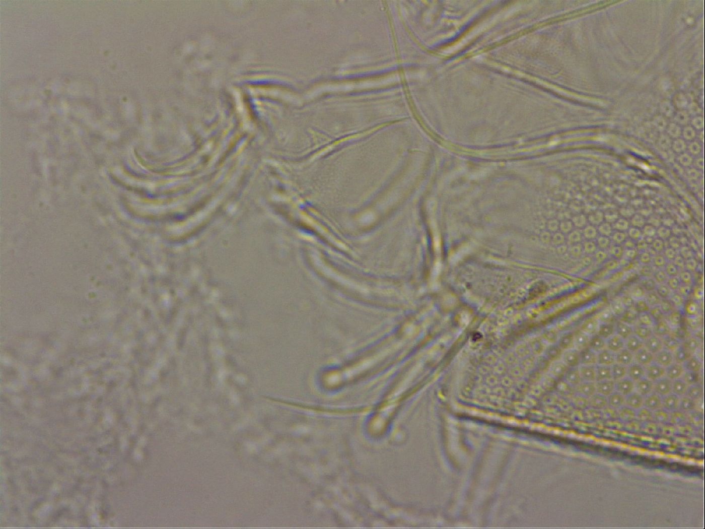 Testechiniscus laterculus image