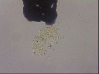 Testechiniscus laterculus image