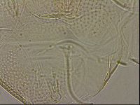 Testechiniscus laterculus image