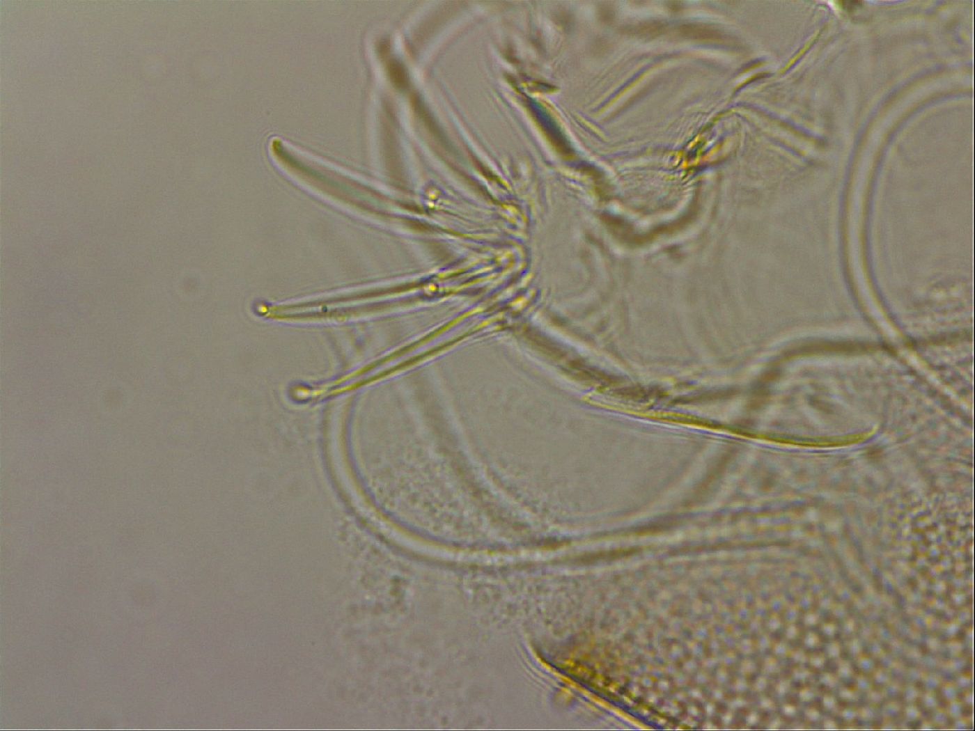 Testechiniscus laterculus image
