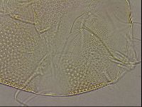 Testechiniscus laterculus image