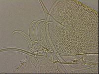 Testechiniscus laterculus image