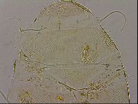 Testechiniscus laterculus image