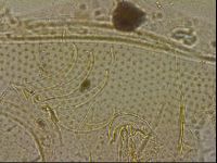 Testechiniscus laterculus image