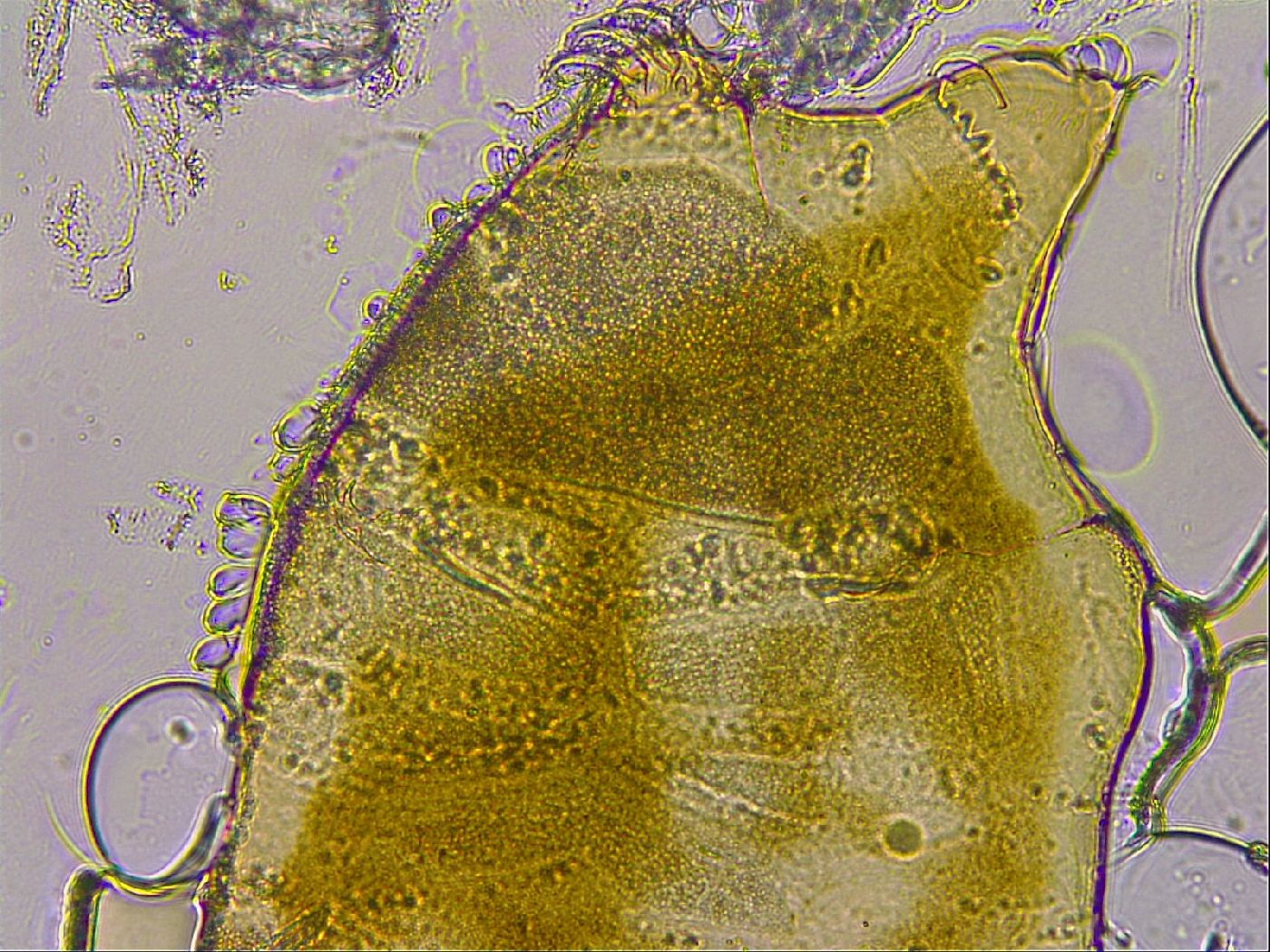 Echiniscus mediantus image