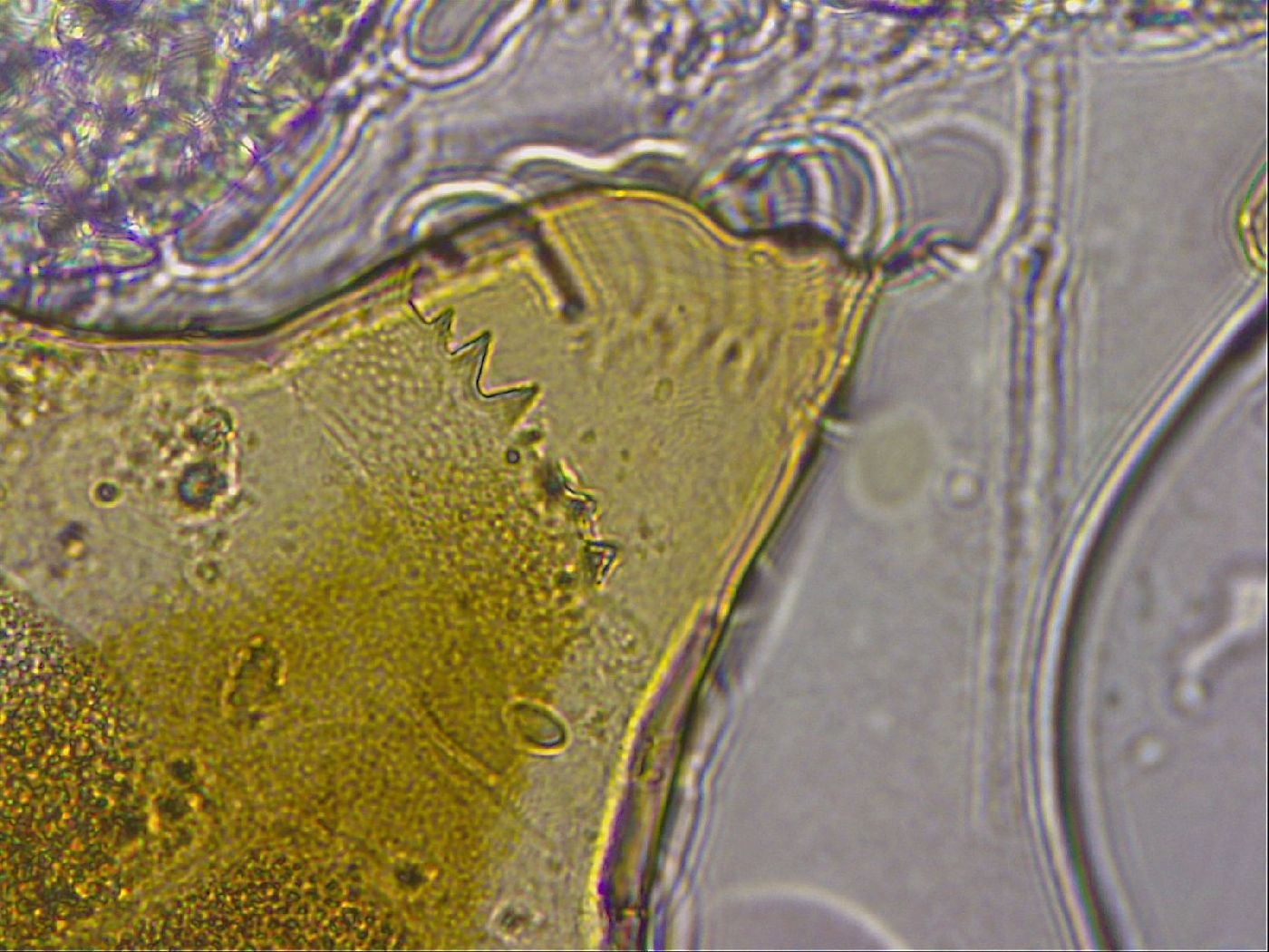 Echiniscus mediantus image