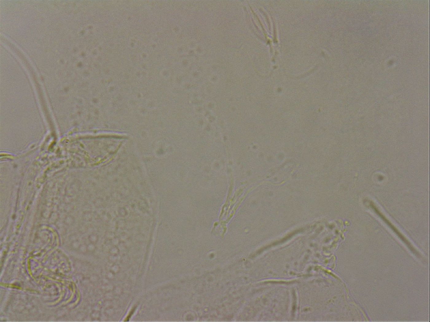 Echiniscus merokensis image