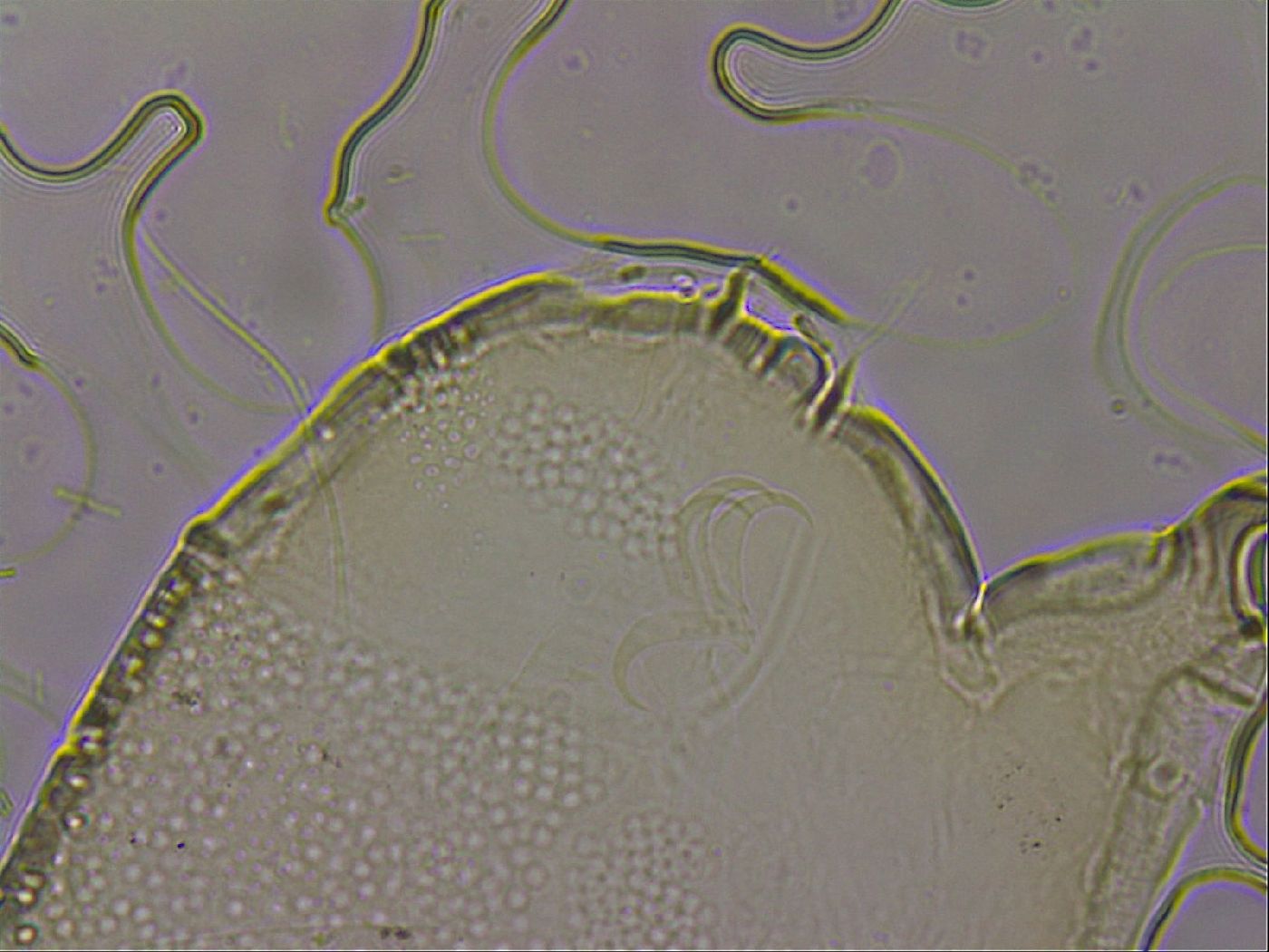 Echiniscus merokensis suecicus image