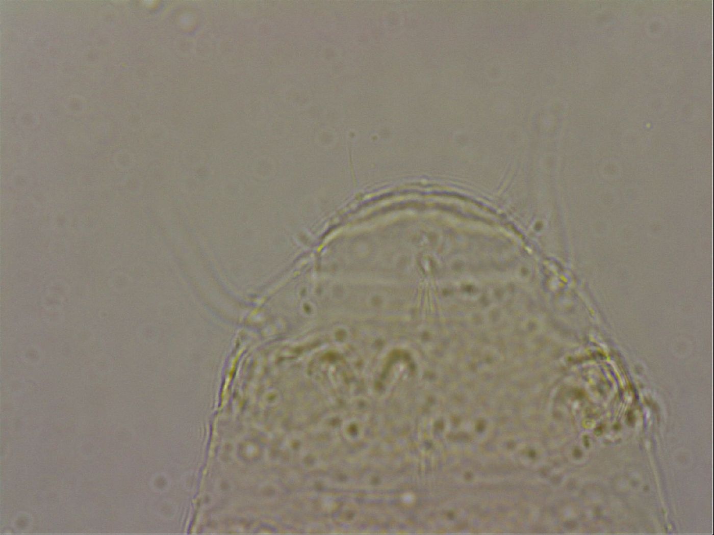 Echiniscus nigripustulus image