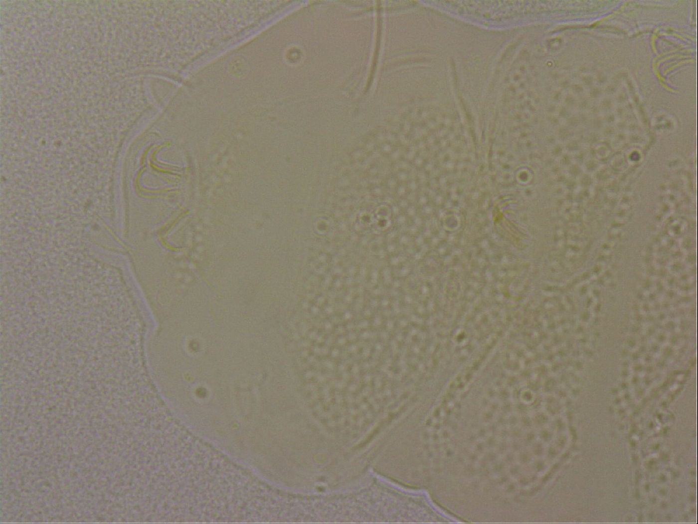 Echiniscus nigripustulus image