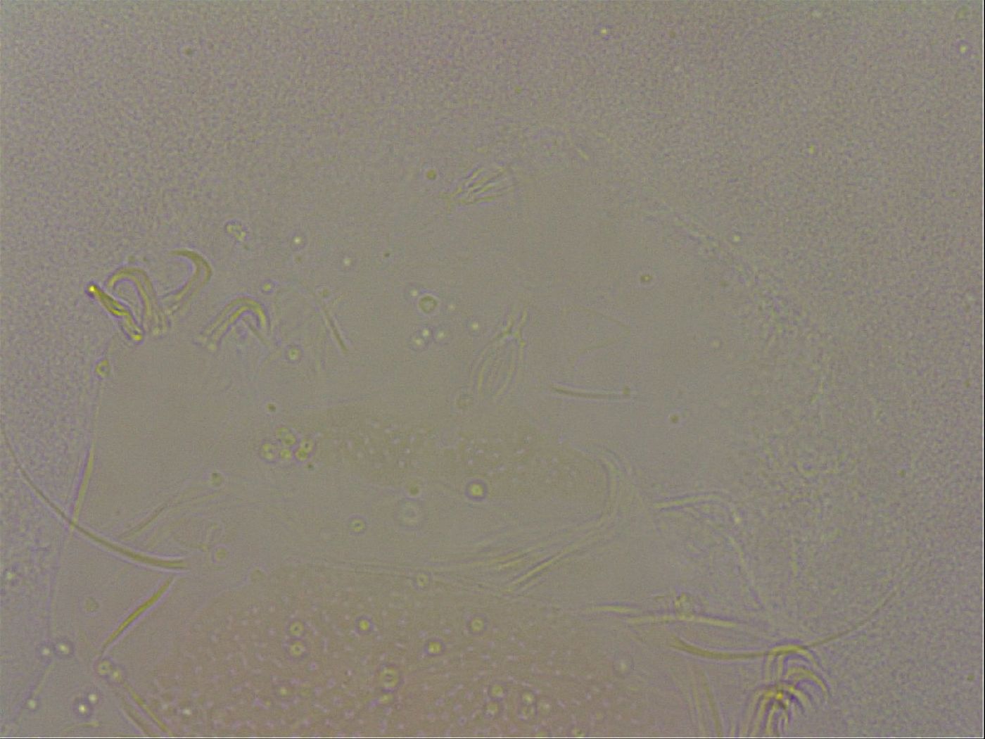 Echiniscus nigripustulus image