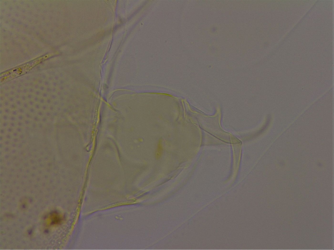 Diploechiniscus oihonnae image