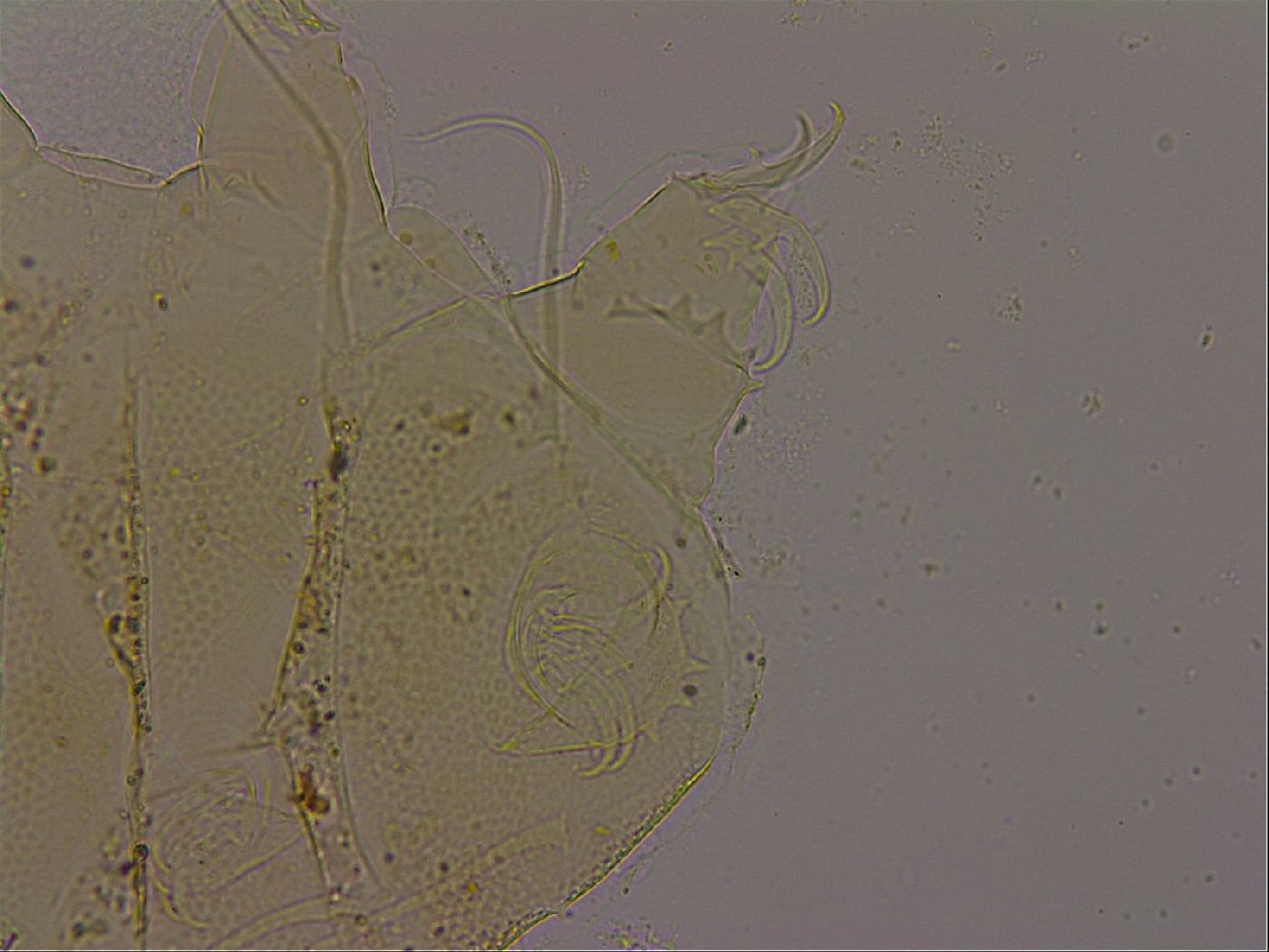 Diploechiniscus oihonnae image