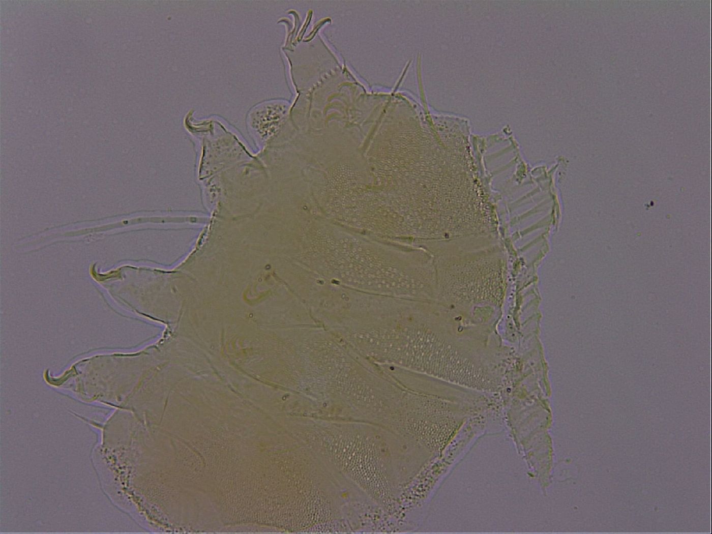 Echiniscus perarmatus image