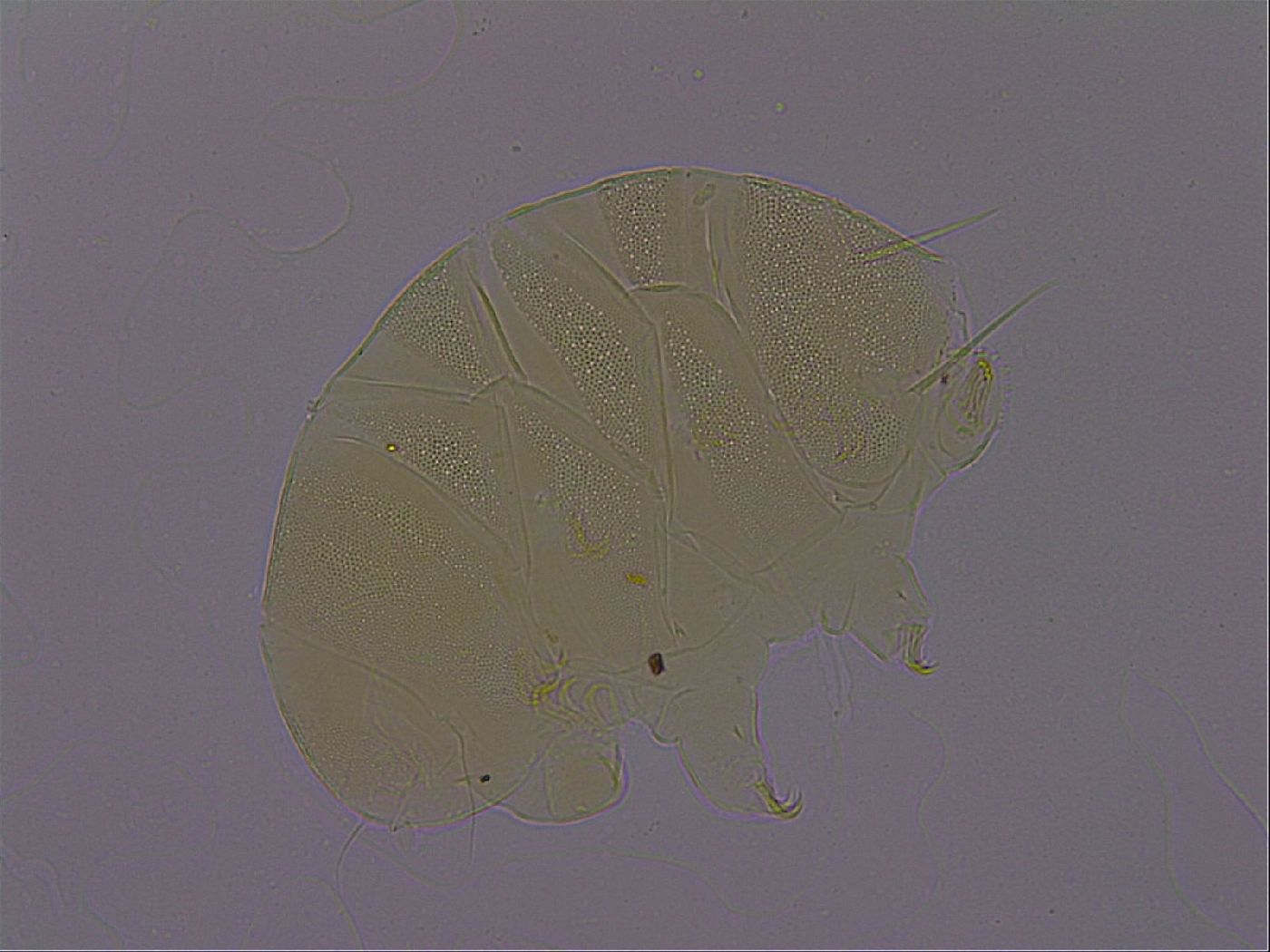 Echiniscus perarmatus image