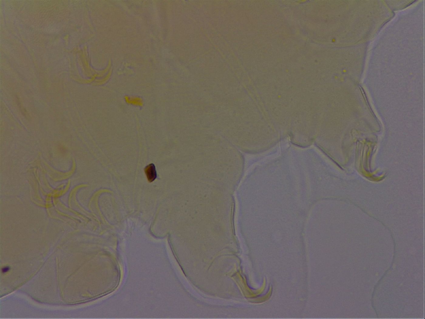 Echiniscus perarmatus image