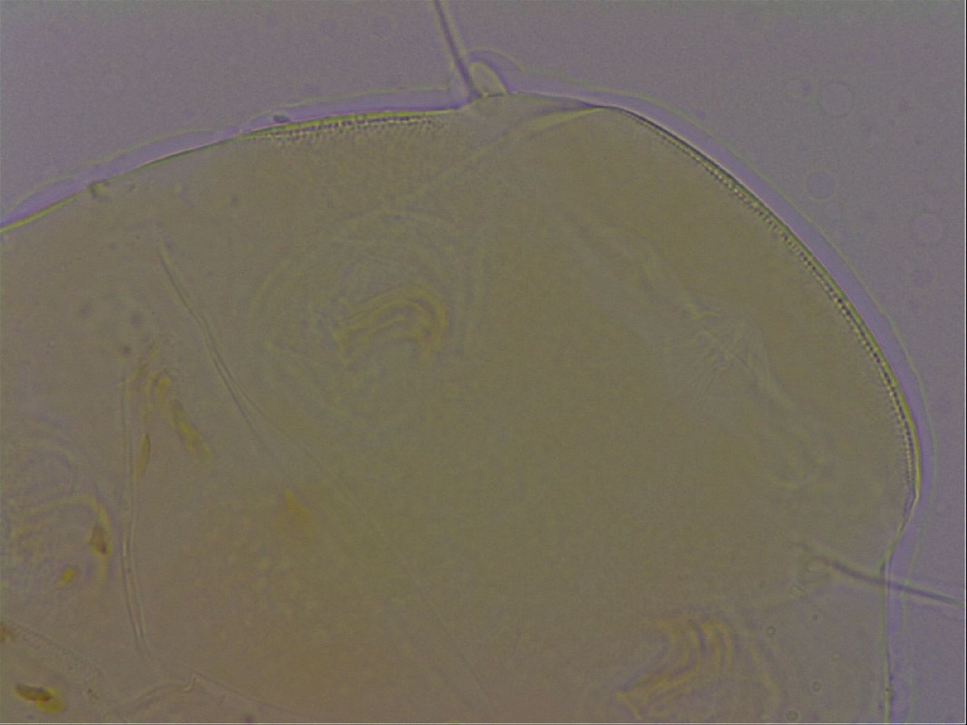 Echiniscus perarmatus image