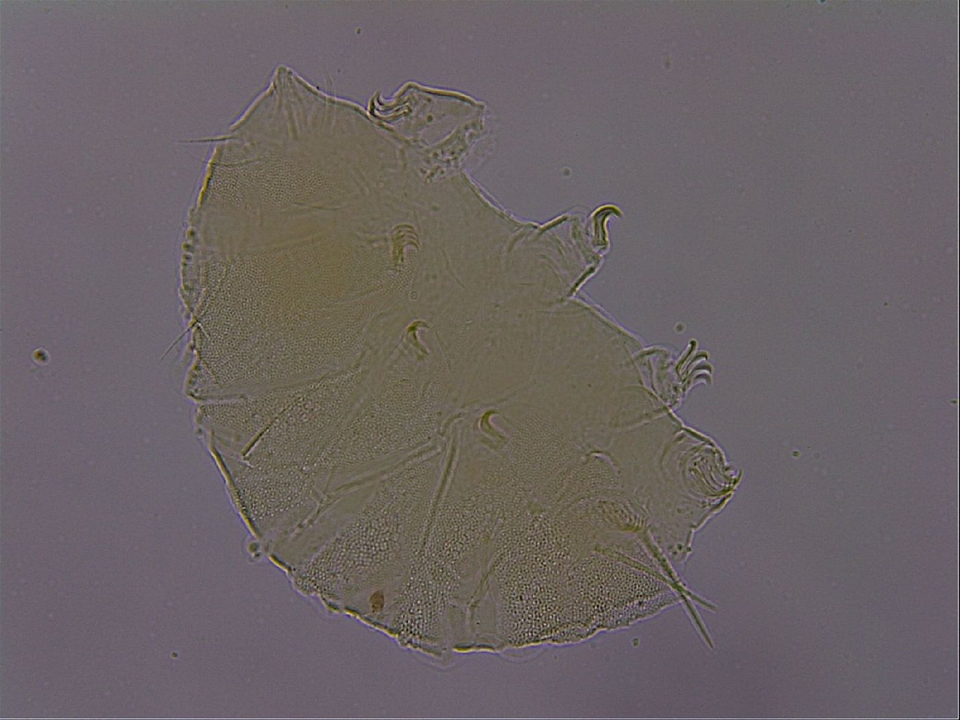 Echiniscus perarmatus image