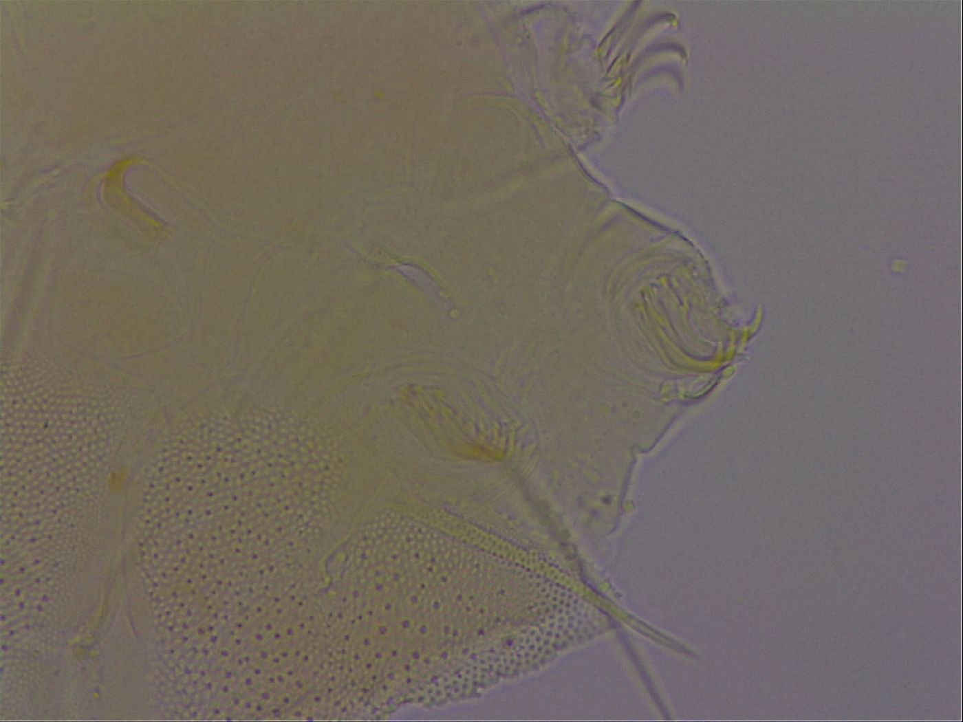 Echiniscus perarmatus image