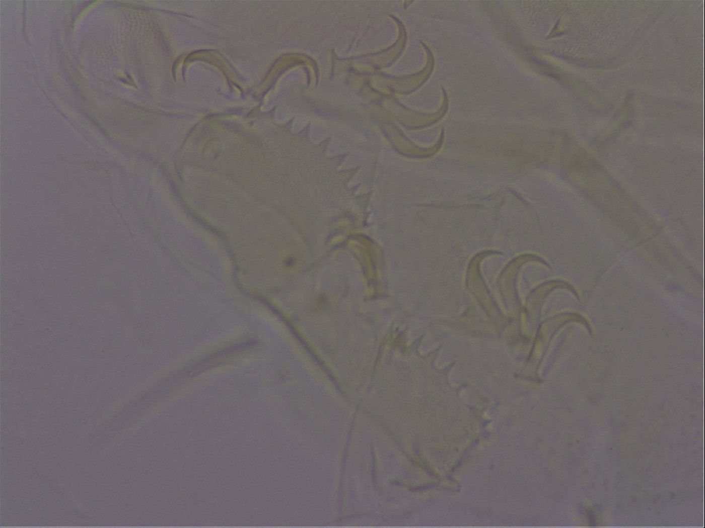 Echiniscus perarmatus image