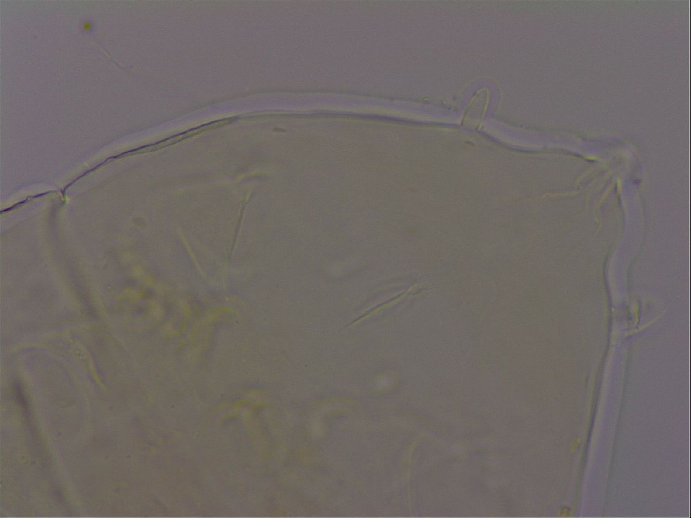 Echiniscus phocae image