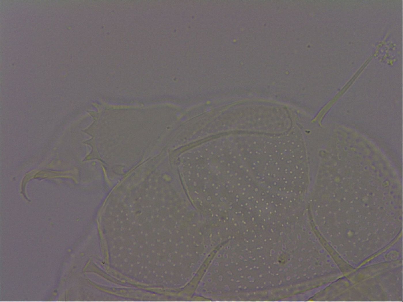 Echiniscus quadrispinosus image