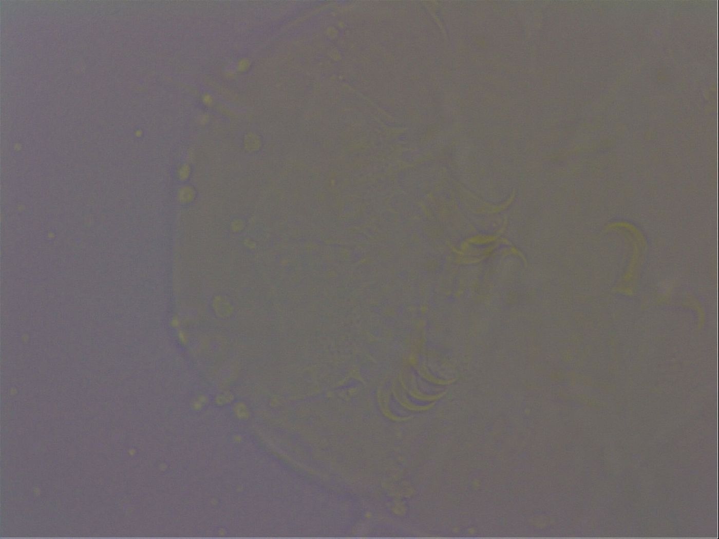 Echiniscus quadrispinosus brachyspinosus image