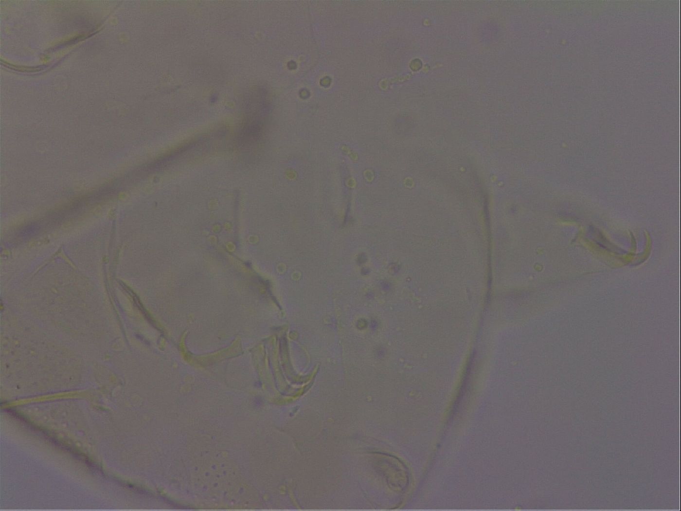 Echiniscus quadrispinosus image